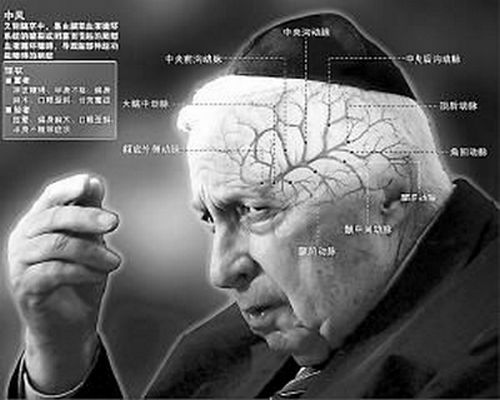 我国脑卒中秋冬季节高发危害程度严峻