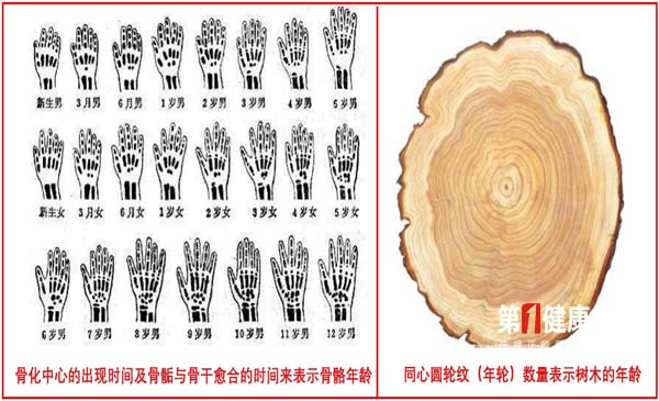 骨化中心的出现时间,及骨骺与骨干愈合的时间来表示骨骼的实际年龄,这