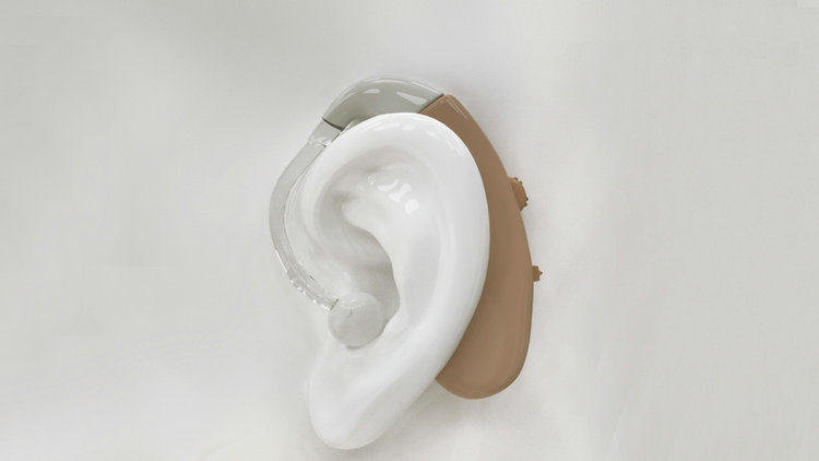 做了新生儿听力筛查，为何还要做耳聋基因筛查？