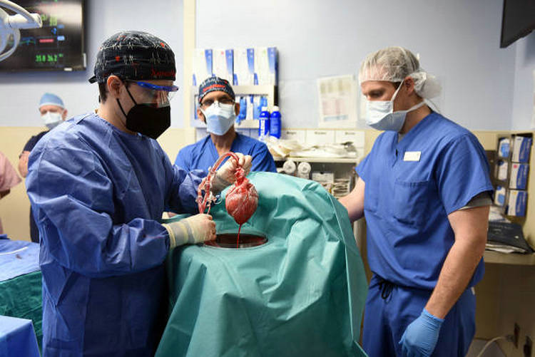 美国完成全球首例猪心脏移植人体手术