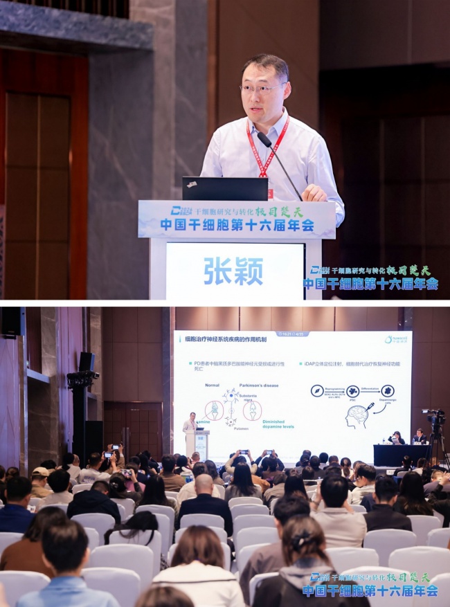 帕金森低免疫原性iDAP疗法再登中国干细胞年会